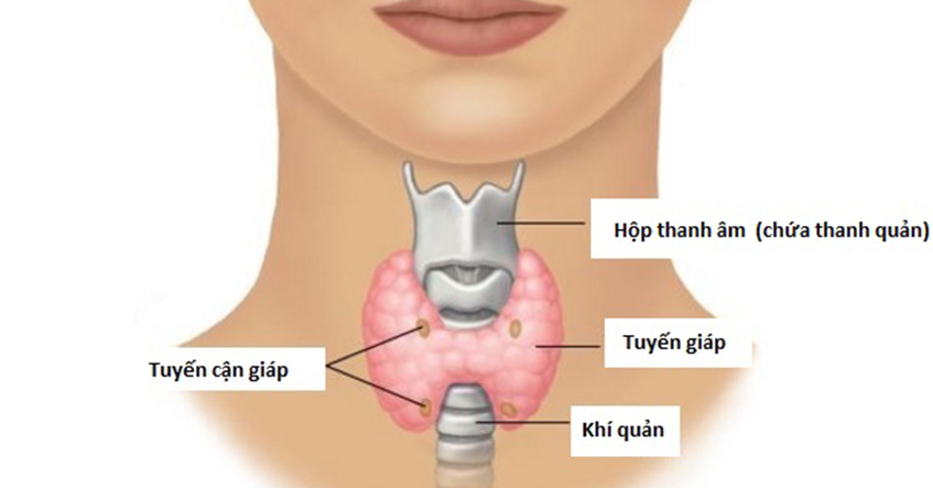 NGUYÊN NHÂN VÀ TRIỆU CHỨNG UNG THƯ TUYẾN GIÁP