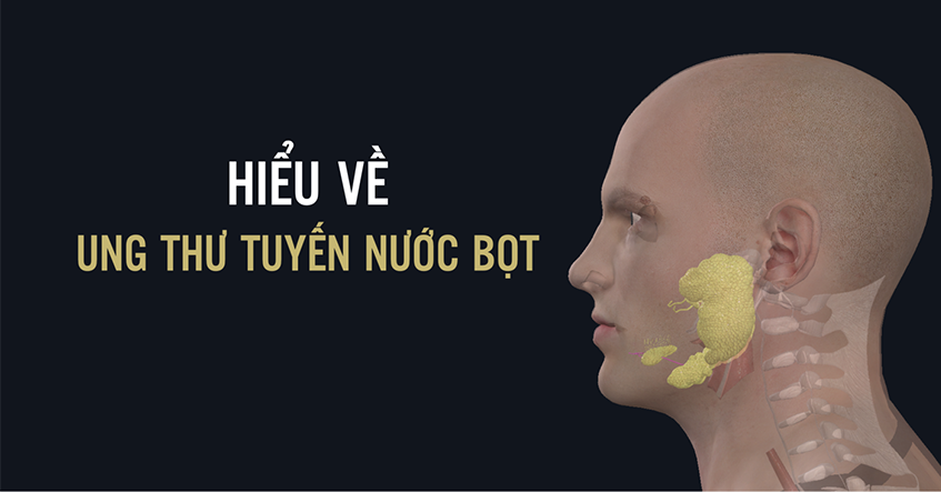 NGUYÊN NHÂN VÀ TRIỆU CHỨNG UNG THƯ TUYẾN NƯỚC BỌT