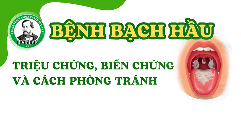 Bệnh Bạch hầu và những điều cần biết