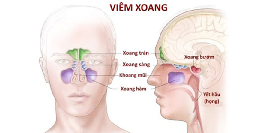 Bị bệnh viêm xoang nên ăn gì