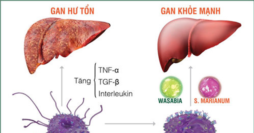 TÌM HIỂU BỆNH VIÊM GAN C VÀ CÁCH HỖ TRỢ PHÒNG NGỪA